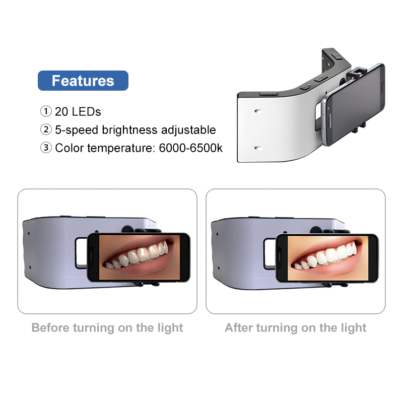 Dental Photography Light With  - Photography High Angle avis et prix